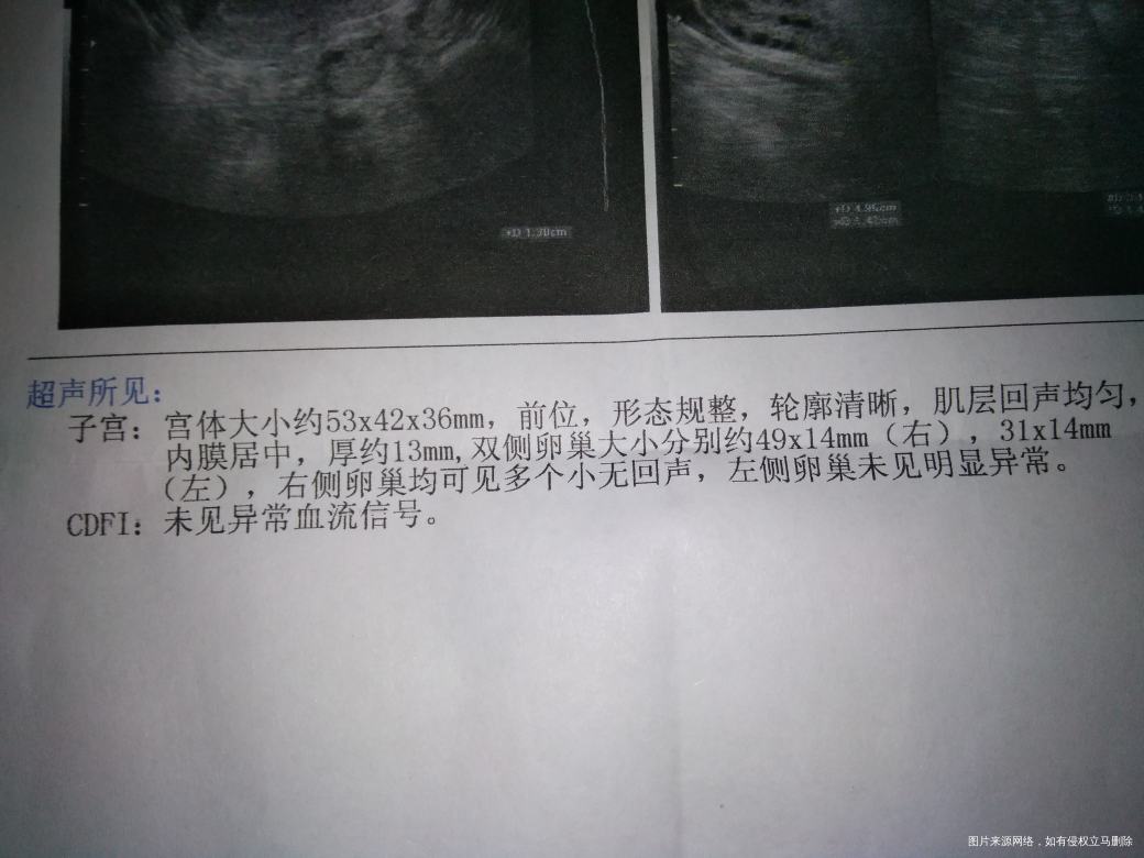 为什么排卵试纸接近强阳了去做B超9显示没有卵泡