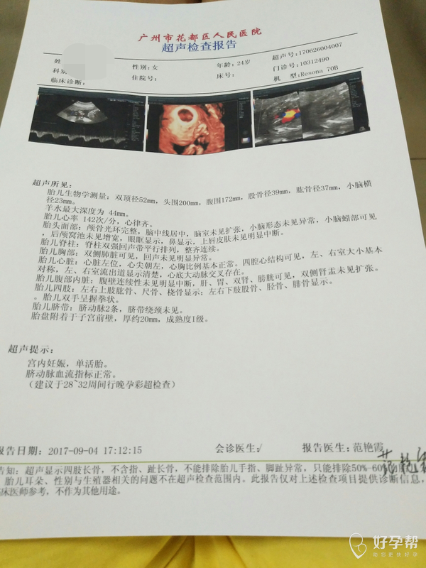 有医生在吗,帮我看看宝宝的三维彩超正常吗?