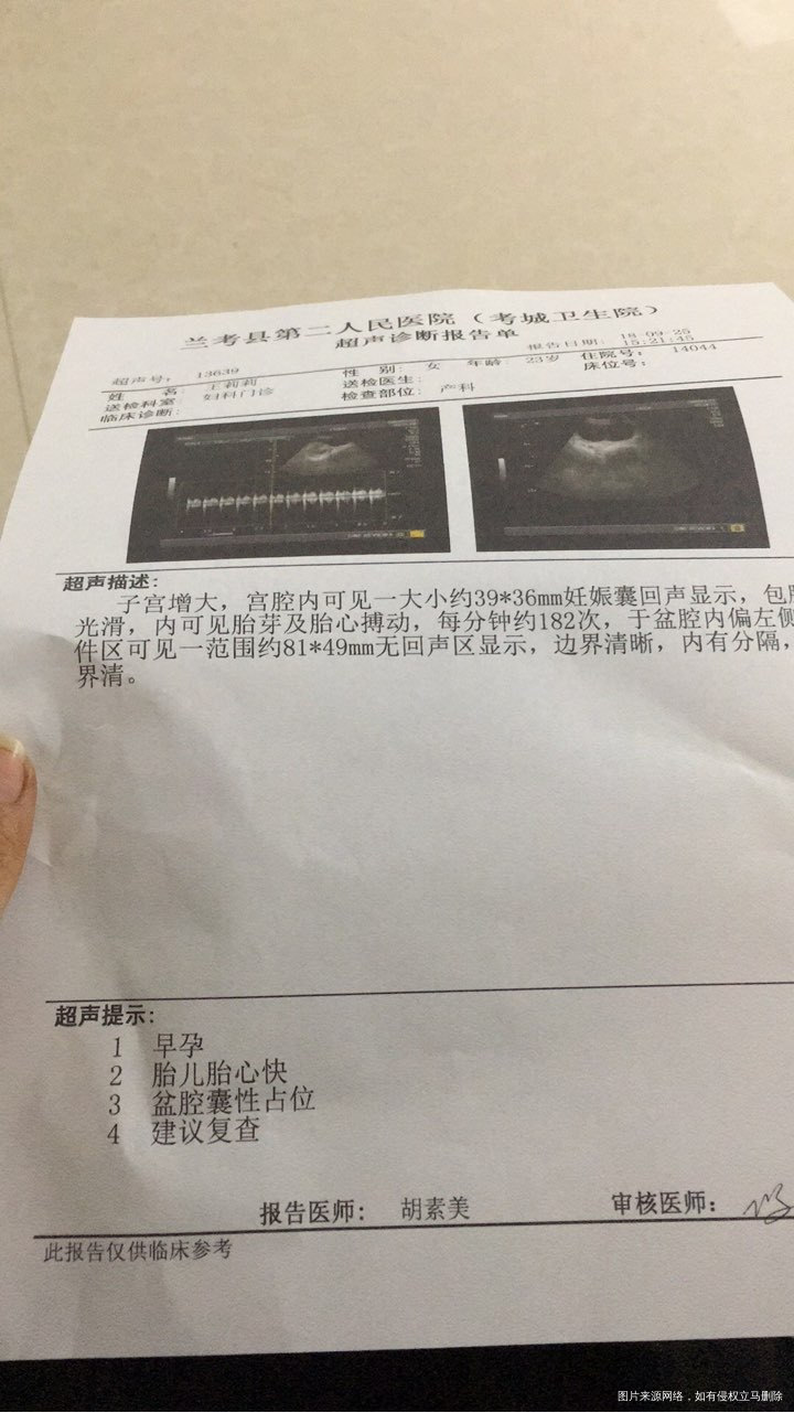 怀孕9周+2,胎心太快。有影响吗