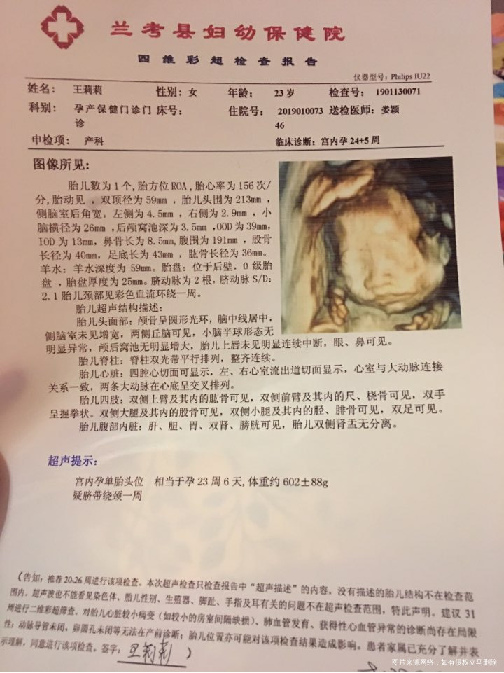 今天刚照的四维,麻烦医生帮忙看一下