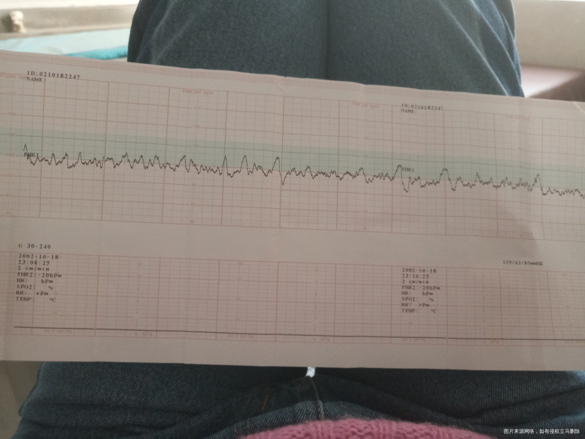 胎心监护基线低怎么办。?