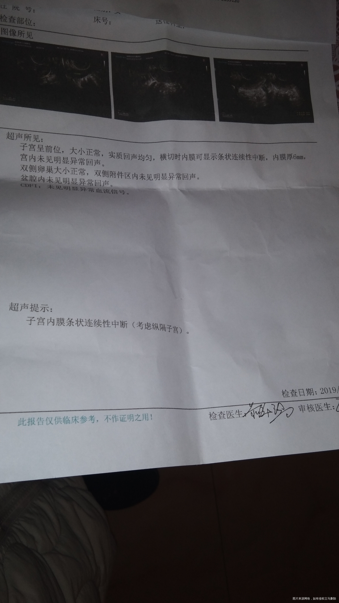 大家帮我看看这单子,我从1月13号来过月经到现在还没来,这单子是3月10号打的,...