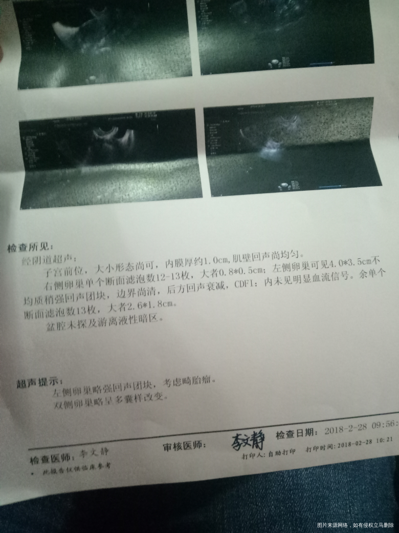 医生,卵泡监测后麻烦看看有问题吗