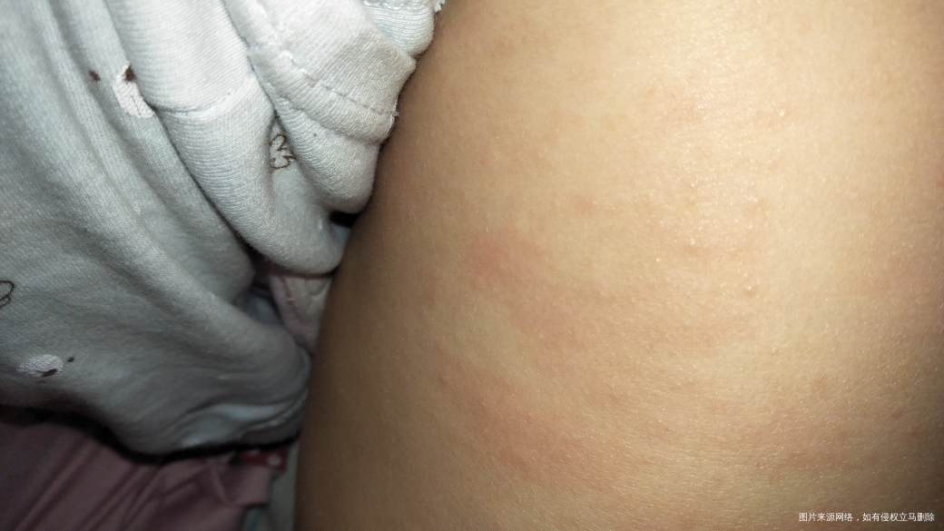 医生有在的吗,麻烦帮我看看