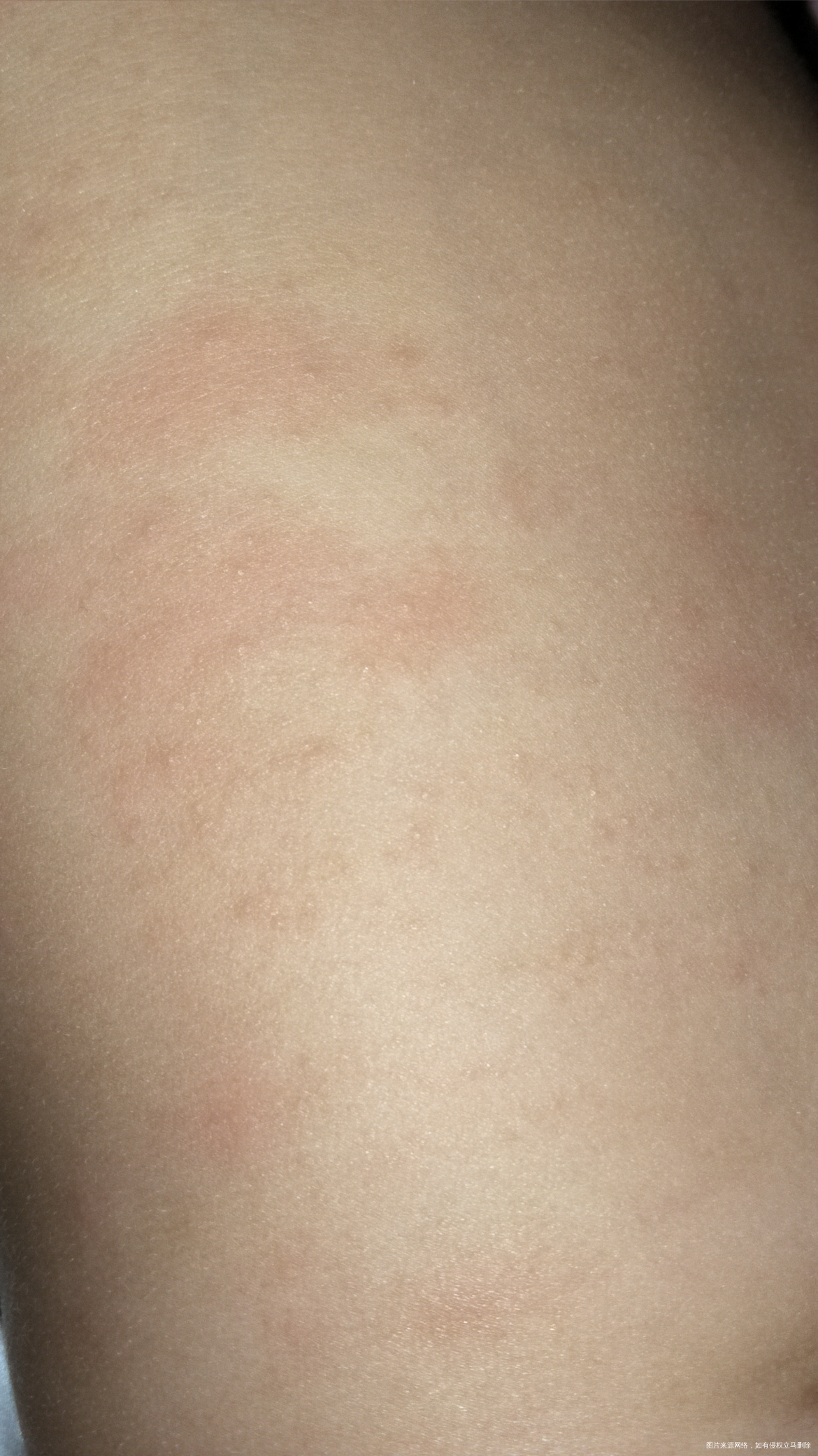 医生有在的吗,麻烦帮我看看