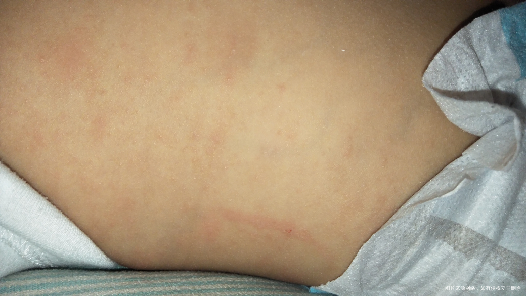 医生有在的吗,麻烦帮我看看