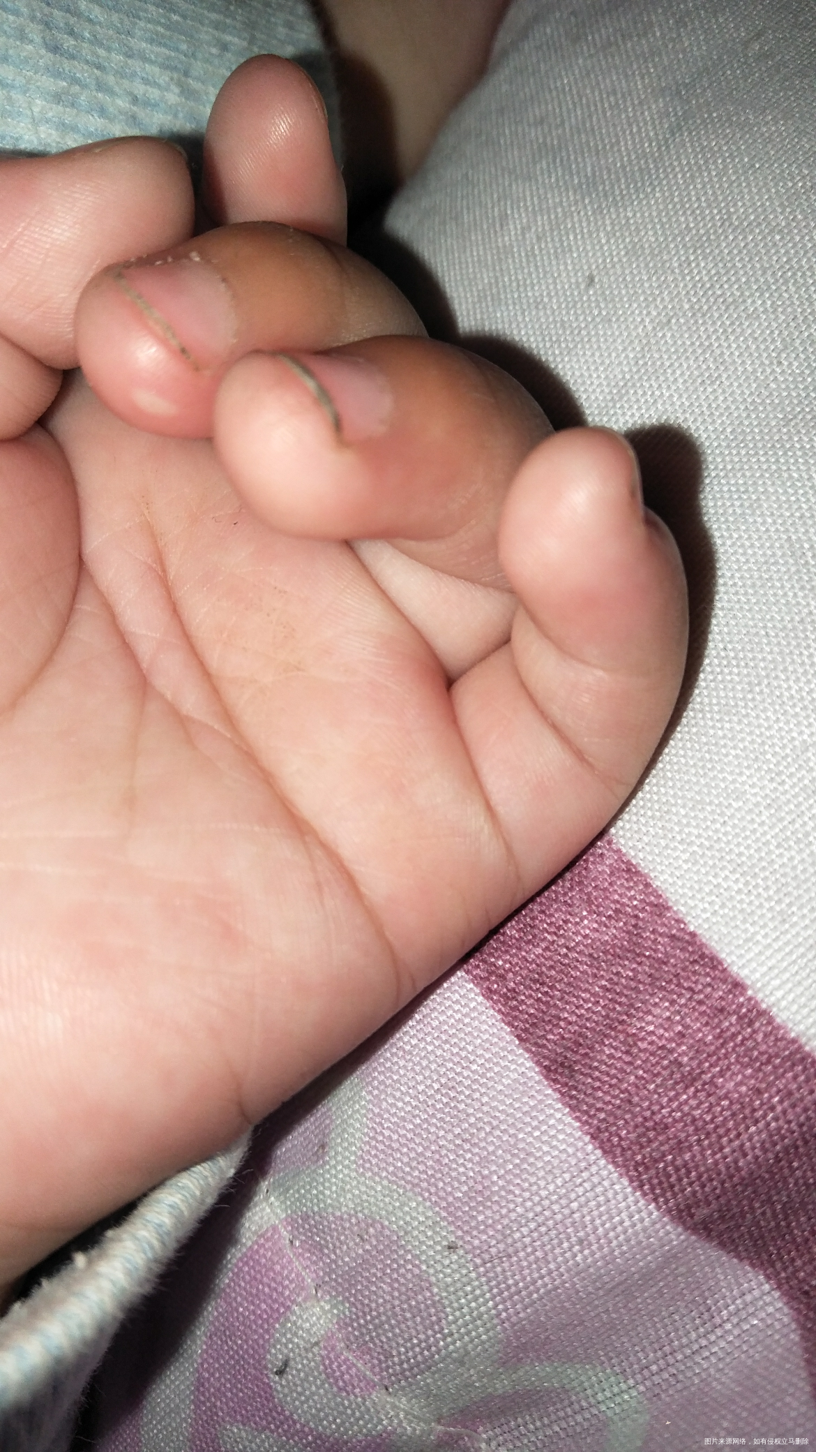 孩子手上最近多了几个白色的包