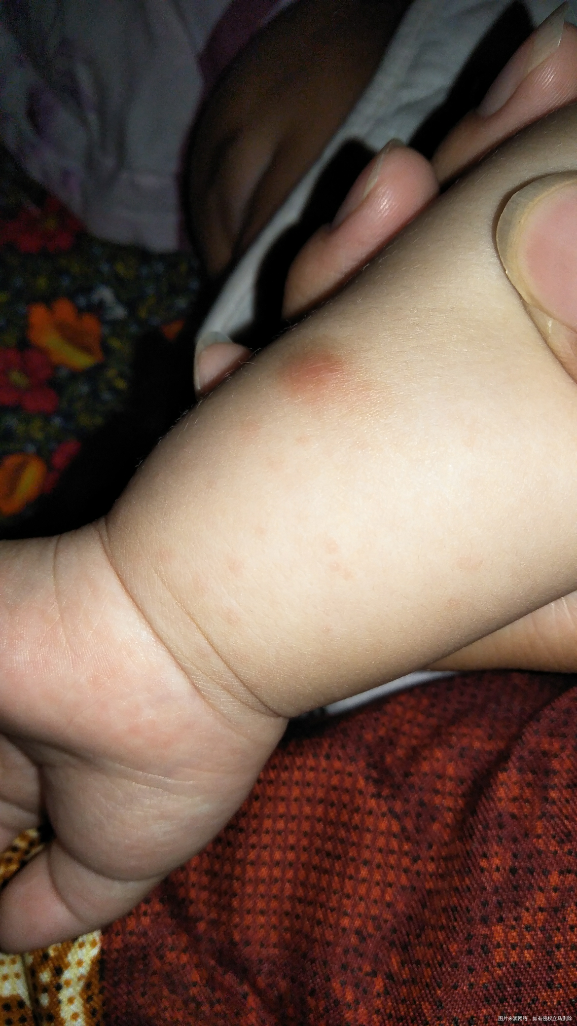 孩子手上最近多了几个白色的包