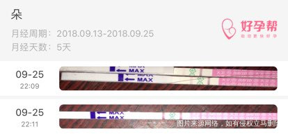 13号来月经,今天第十三天,b超显示卵泡20×19,这是要排卵了吗?