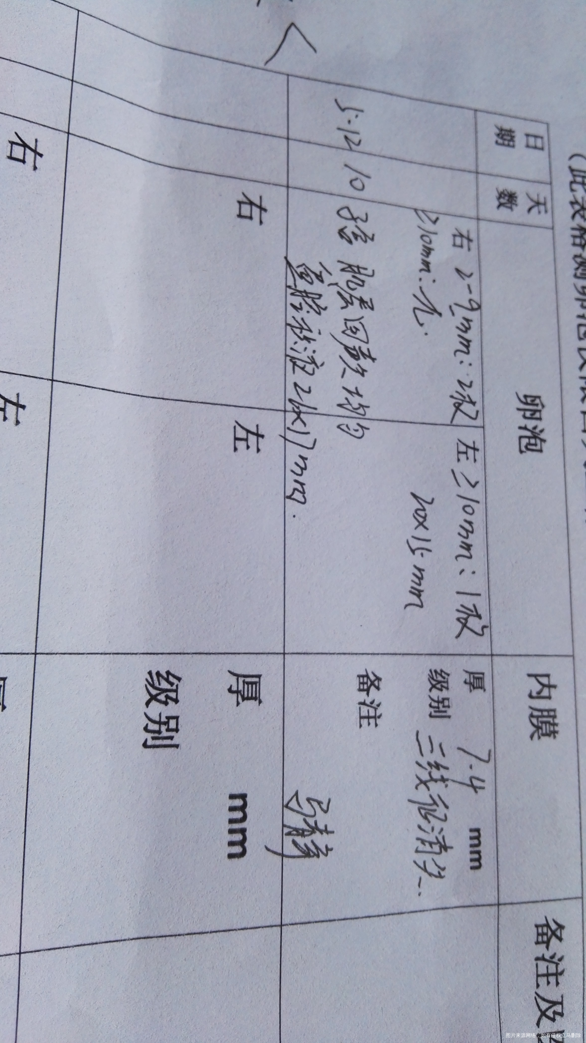 有医生在吗?帮我看看我的b超监测报告