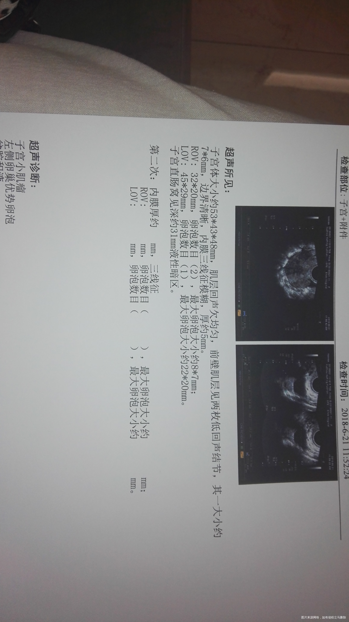 2018年6月21日星期四天气晴
今天是例假完了的第六天,试纸强阳了,也去医院b…
