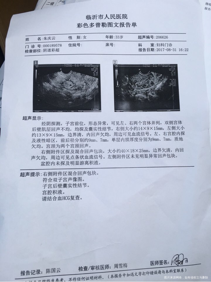 劳烦医生给看看是宫内还是宫外