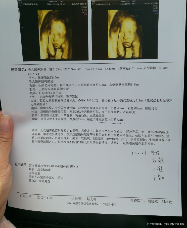 可以看出来男女吗,有没有行家帮忙看看