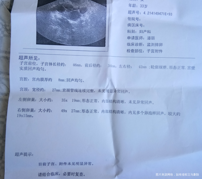 有医生在吗,求助一个关于促排的问题