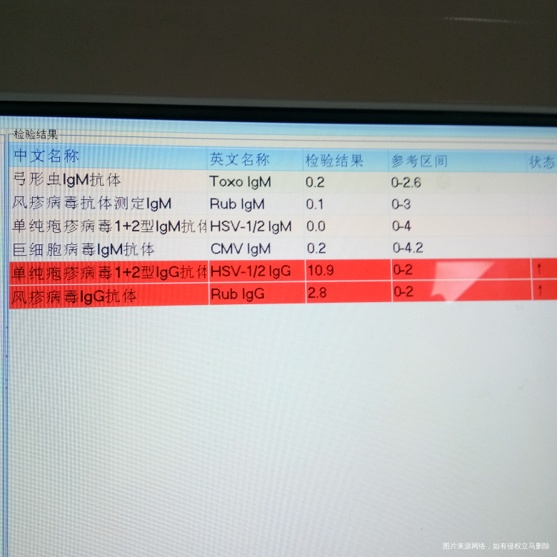 有医生在吗?帮我看看检查结果