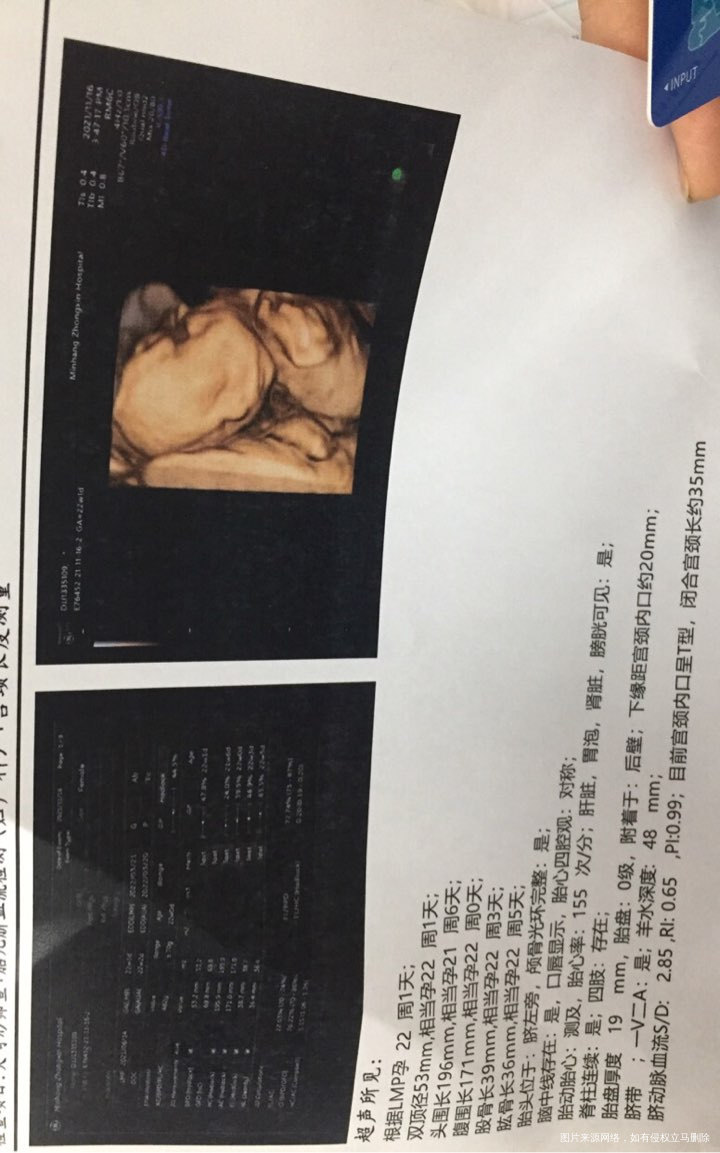 哈哈,4维通过,22周➕1