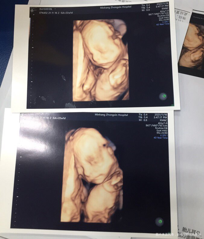 哈哈,4维通过,22周➕1