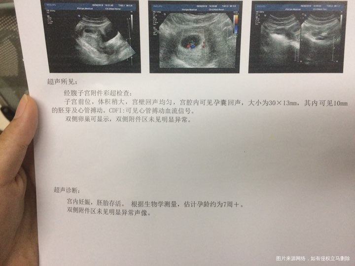 终于测到胎心胎芽了,好开森