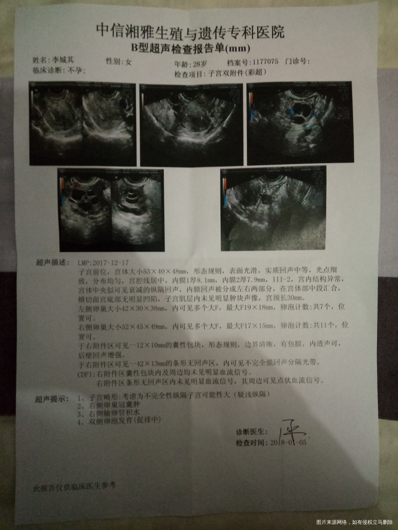 试管今天打夜针了,但是发现了积水,医生我要结扎吗?