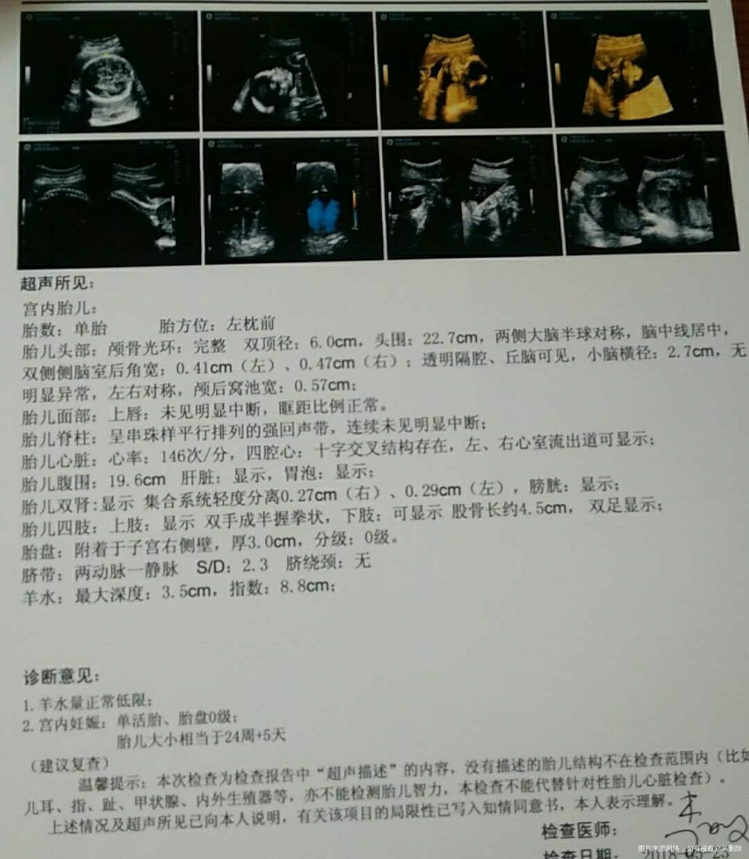 麻烦医生帮我看看,让复查,谢谢