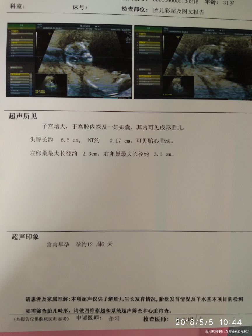 NT通过!验了5管血,还没出结果。
明明12周,却显示12周6天,医生说宝宝长得…
