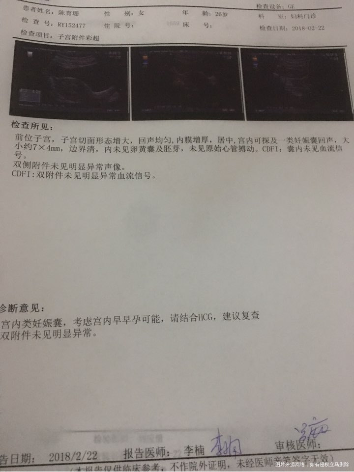 急,医生帮我看看怀孕40天