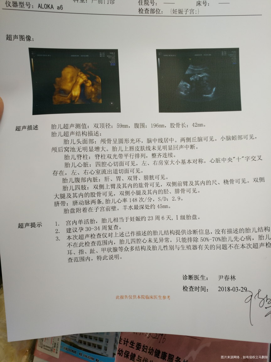 请医生帮忙看看四维彩超单,谢谢!