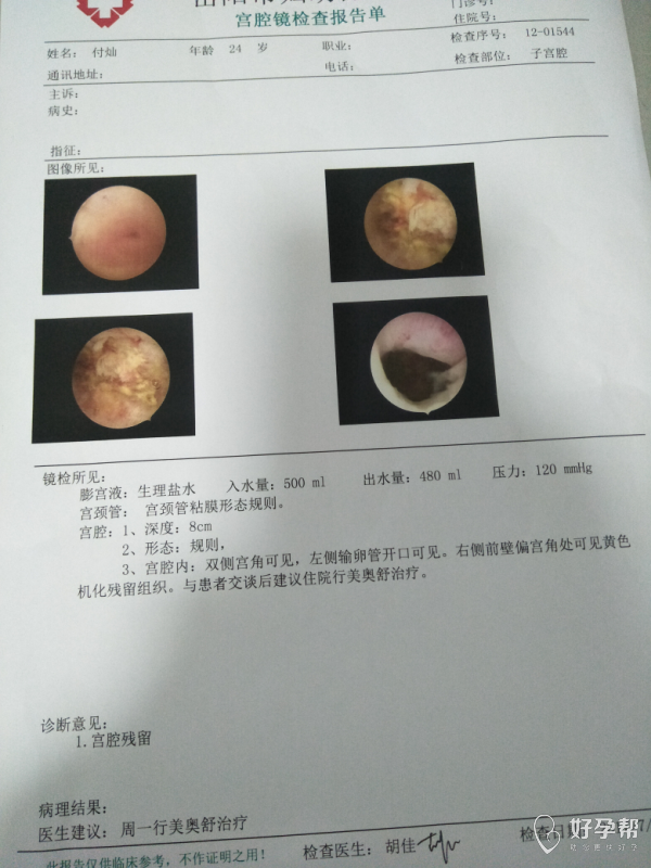 今天又安排了宫腔镜检查,说有残留