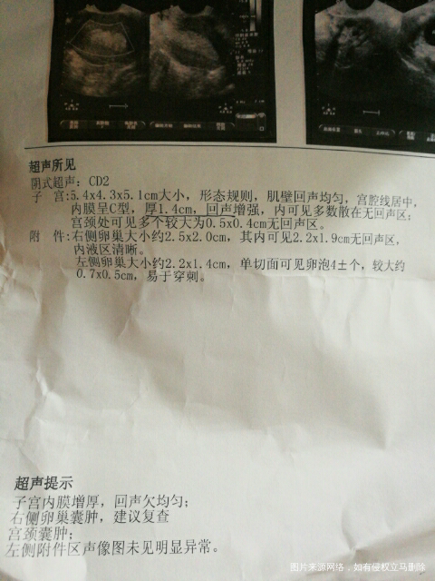 为啥内膜这么厚 经量却很少 少的可怜