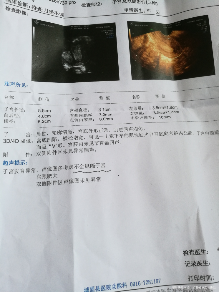 上个月月经结束第三天做的b超 开了10天的黄体酮