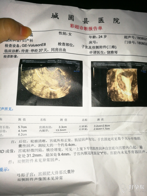 请问我的弓形子宫 最宽处31.2 最深处9.1 需要治疗吗