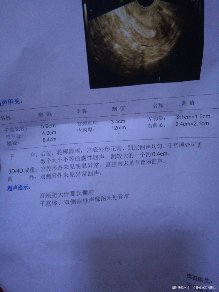 70天没来月经了 查了一大堆 医生只说打黄体酮 不知道内分泌正常吗麻烦医生看下