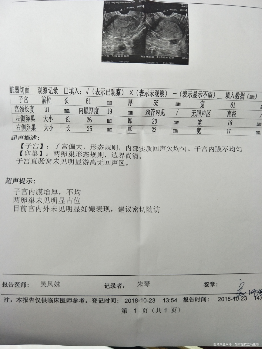 HCG降了又升上去了,做B超宫内宫外都没找到东西,不知是不是宫外孕
