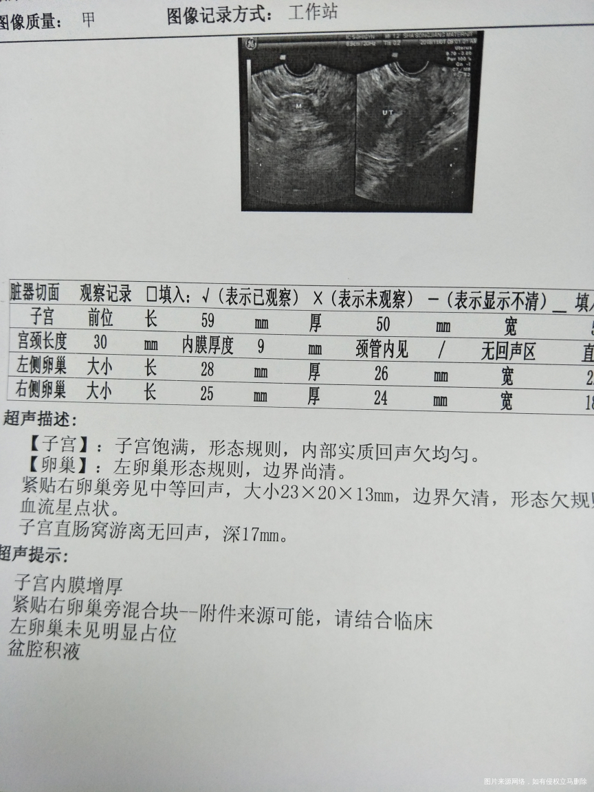 宫外孕保守治疗HCG降了一半,但包块却还在长,请问还是要手术吗