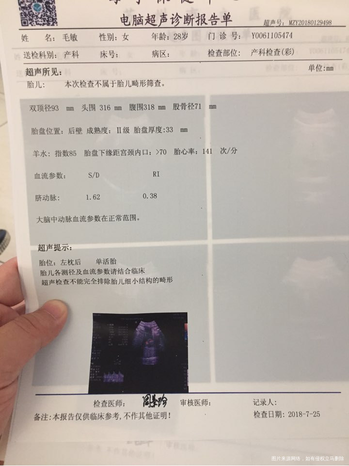 麻烦医生看看宝宝好不好?脐带是否绕颈?宝宝多重?是否可以顺产?