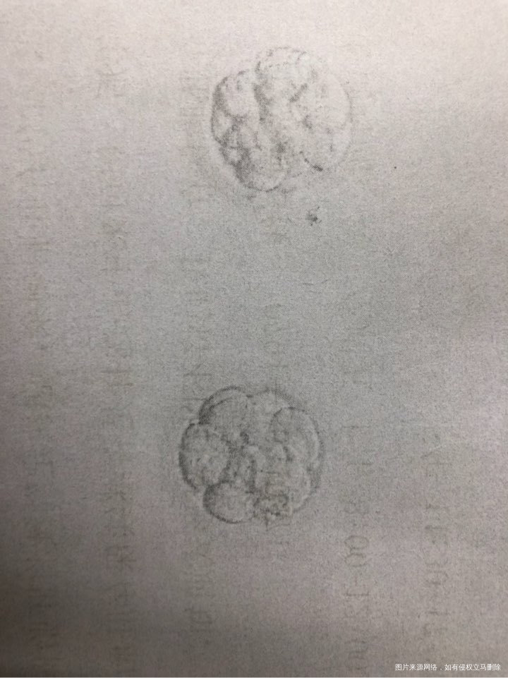 求帮忙看看这是几细胞