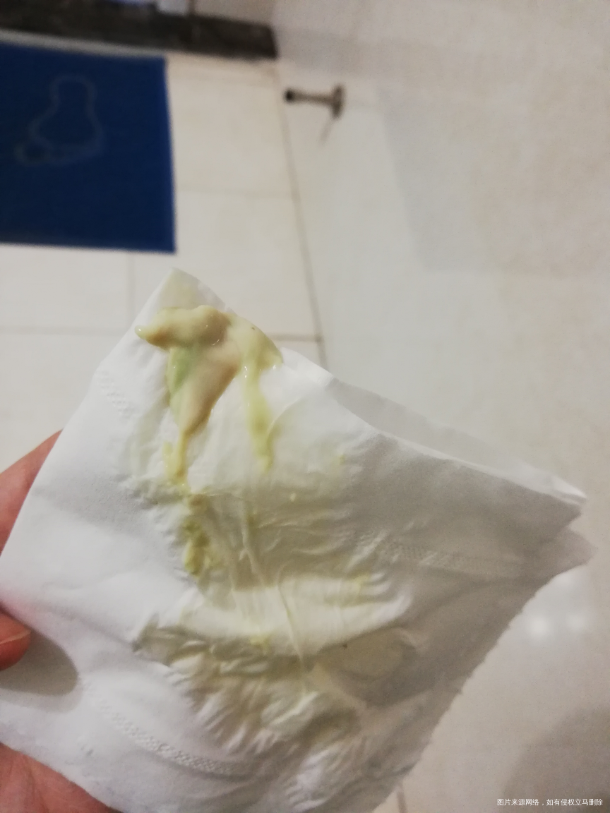 孕16周多,有乳白色和黄绿色分泌物?