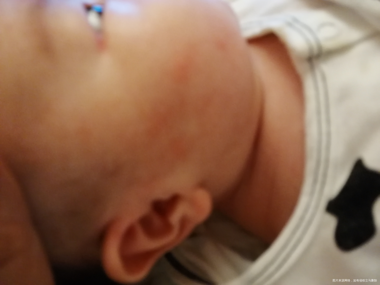 婴儿吃了施保利通片,身上起疹子