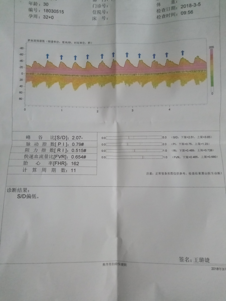 脐血流报告,医生帮忙看一下!