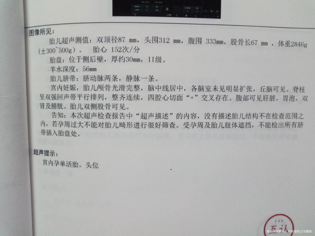 37+2做的BC,医生帮忙看看!