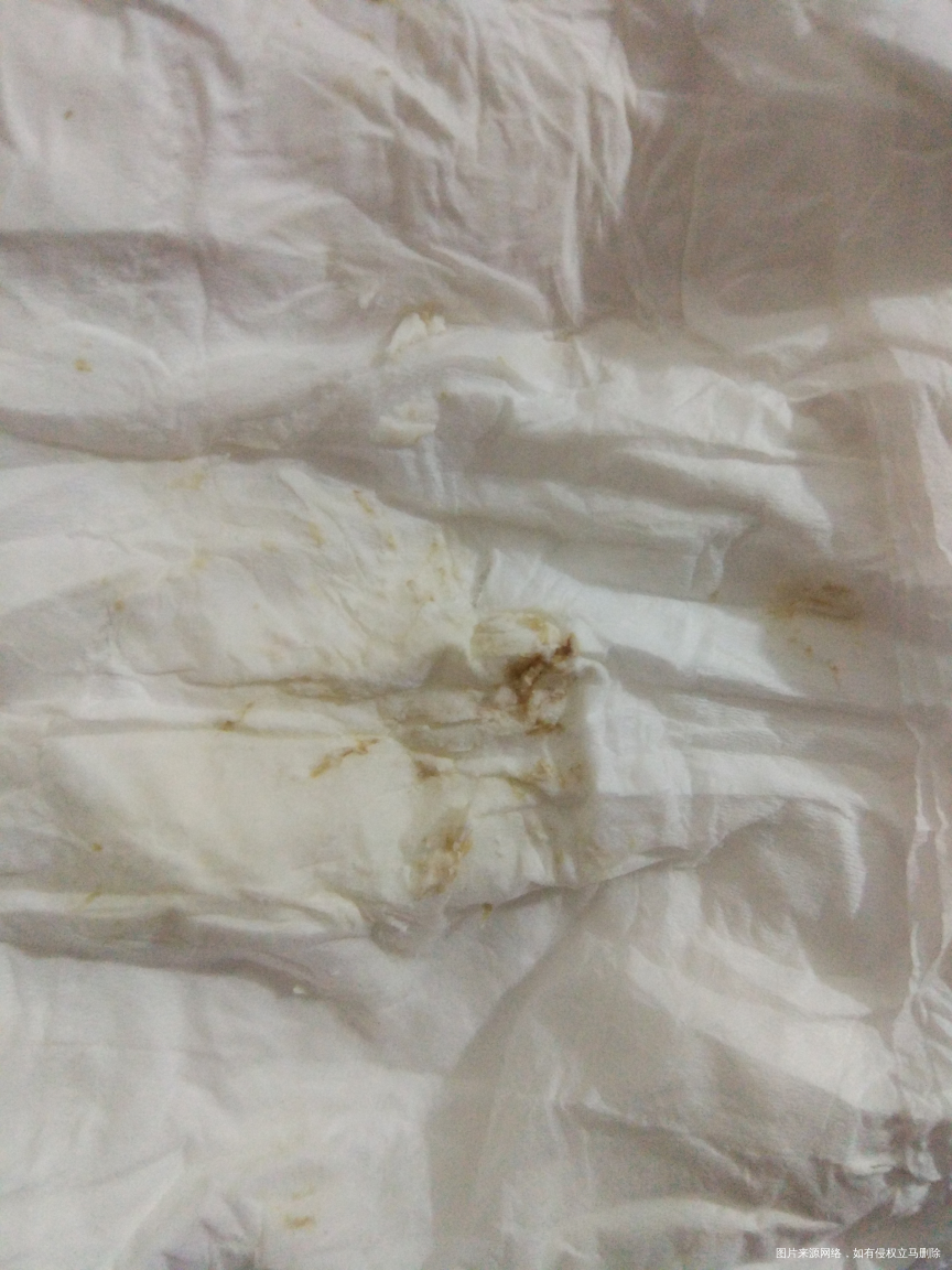 医生麻烦帮忙看看,怎么这样