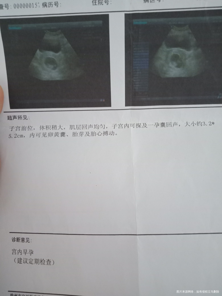 #我的每一次产检#宝宝给力,产检每次都通过