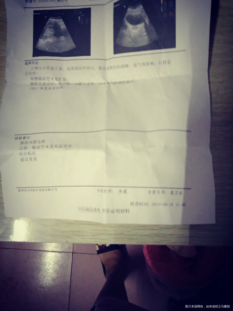 你们得过膀胱炎吗。总是尿频,检查结果……