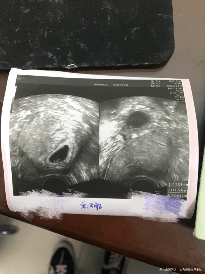 一超顺利通过,胎心胎芽都有了!南无阿弥陀佛南无阿弥陀佛!