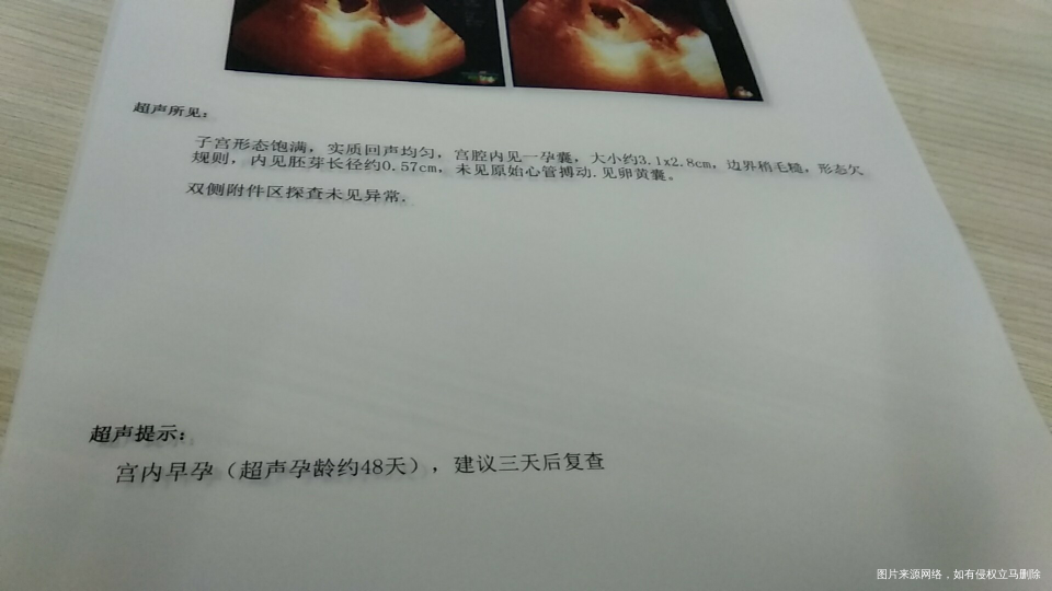 我是不是胎停育了?还是有希望呢?