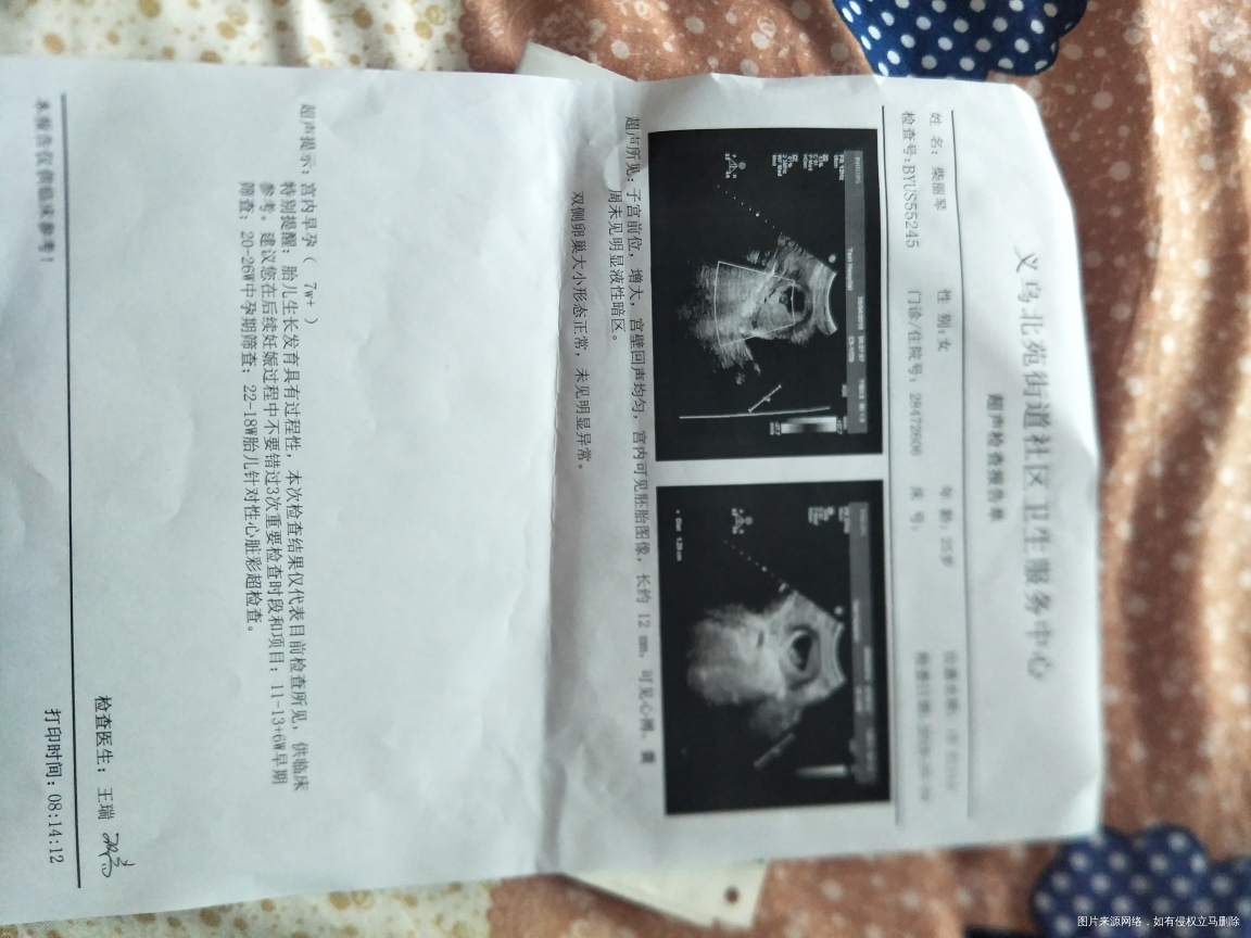 哪个内行,求求,帮我看看