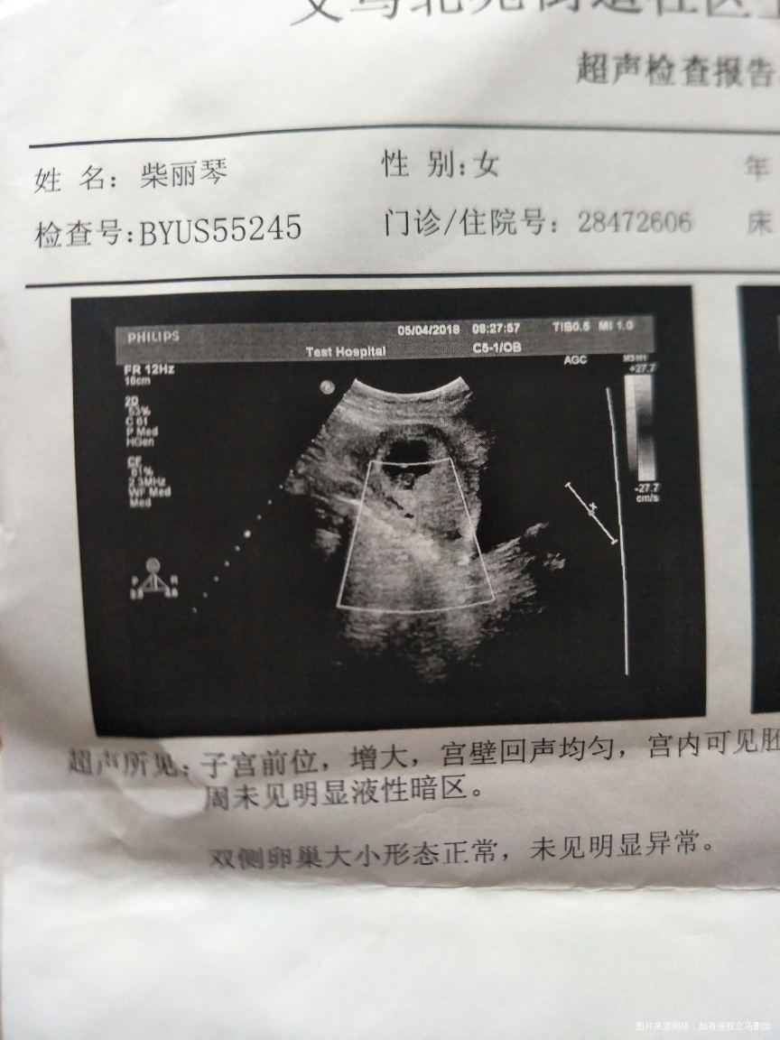 哪个内行,求求,帮我看看