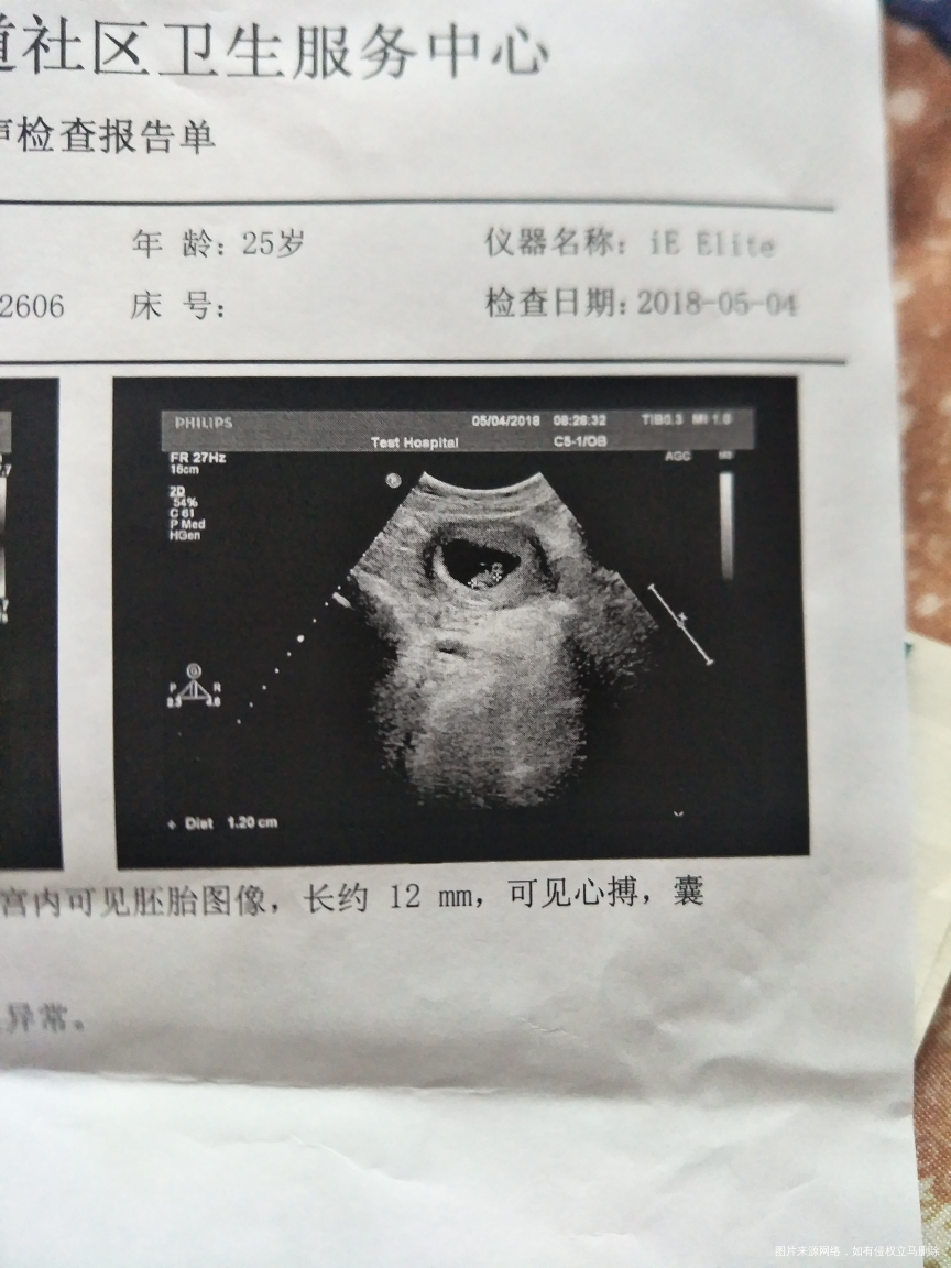 哪个内行,求求,帮我看看