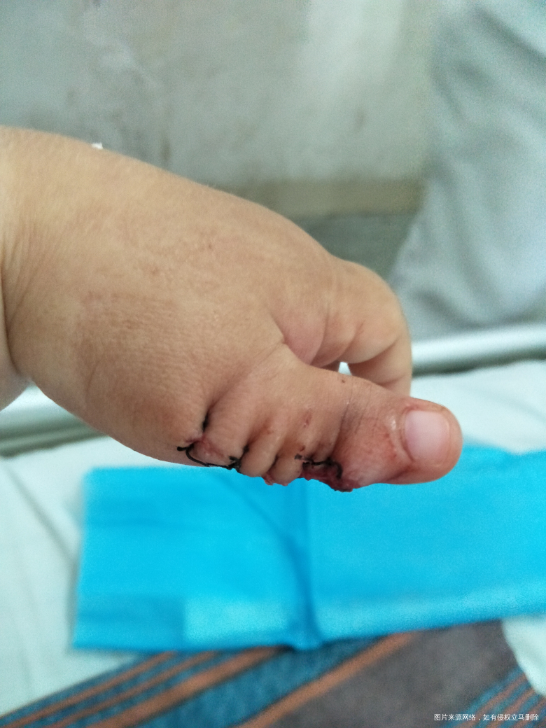 【黑色的八月】宝宝医院篇