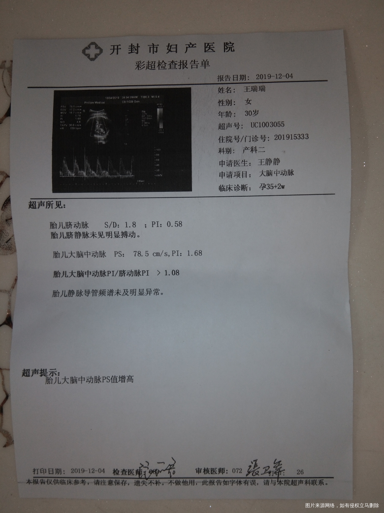 医生在吗 麻烦帮忙看一下